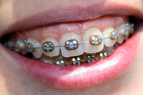 Orthodontics